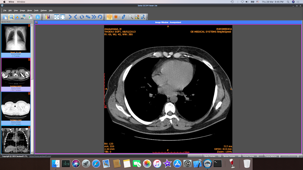 Dicom Viewer For Mac Free Download
